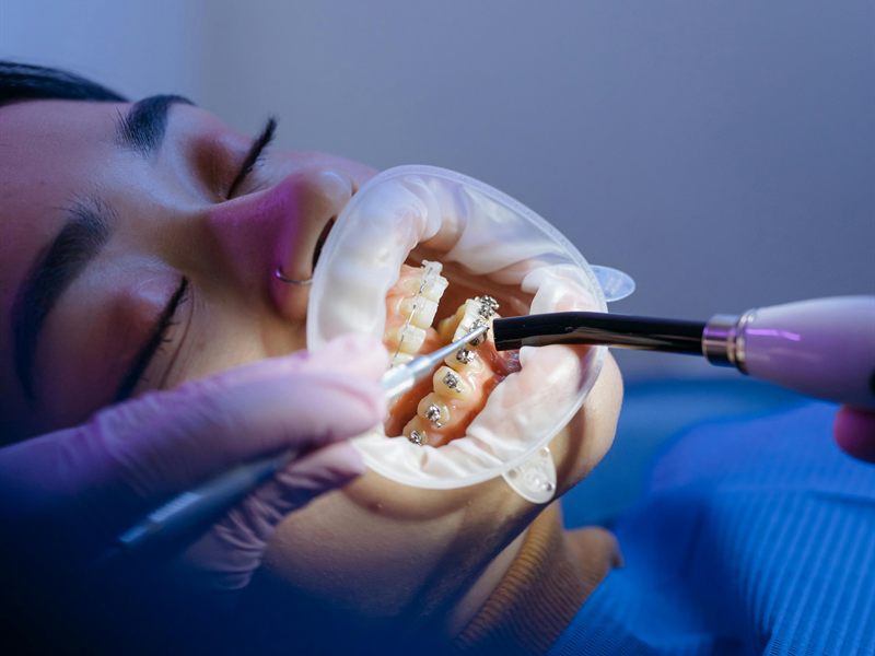 Klinikte tedavi hazırlığı